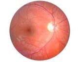 Retinal Image